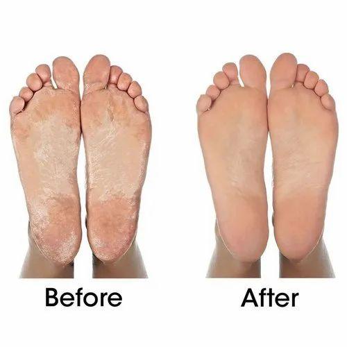 Silicone Blue Socks - Unisex Silicone Gel Heel Socks With Spa Botanical Gelpad